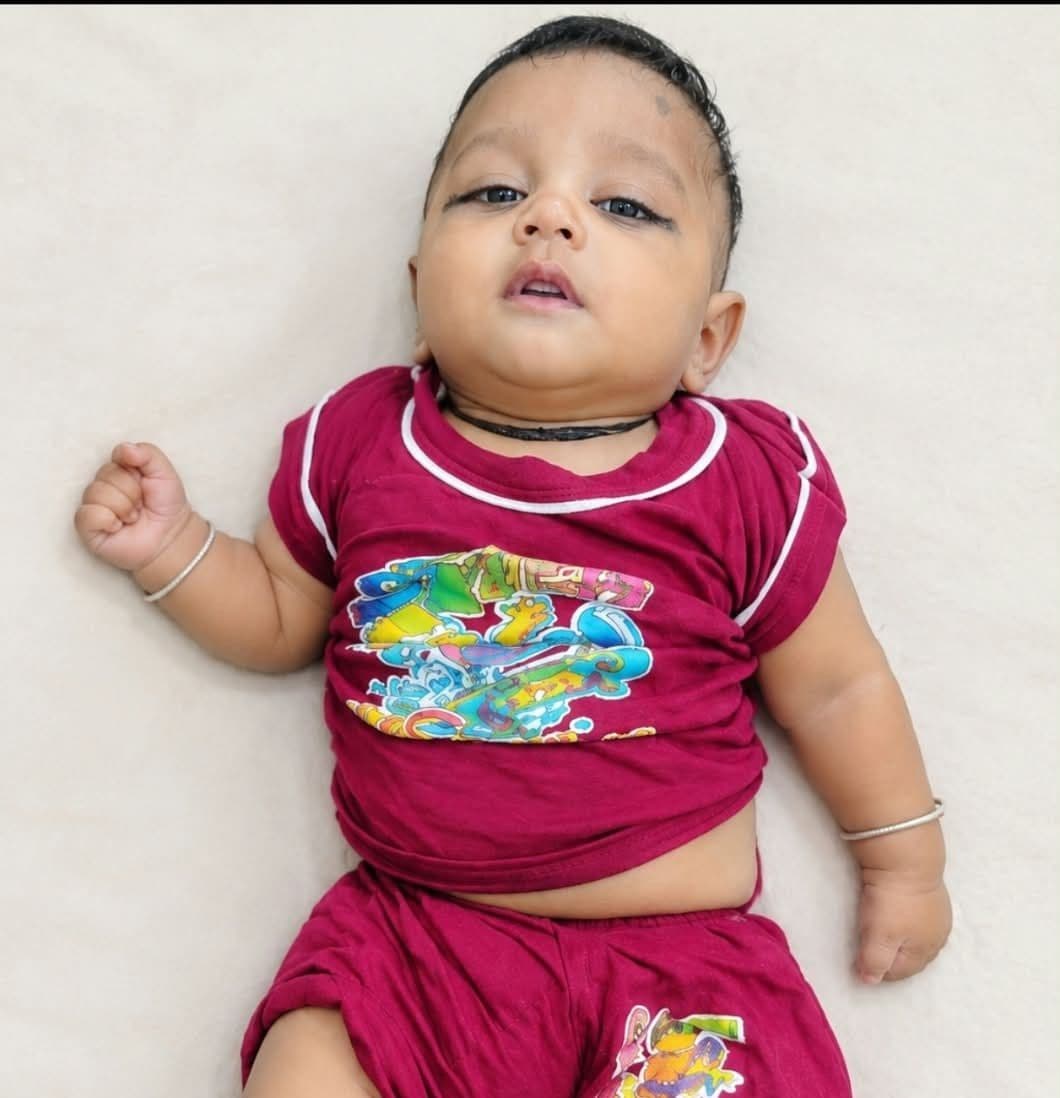 Urgent Foot Correction Surgery for Master Jishan, 5 Months